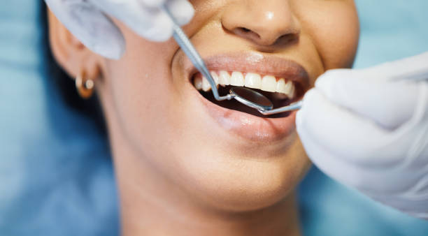 Best Knocked-Out Tooth Emergency  in Faribault, MN